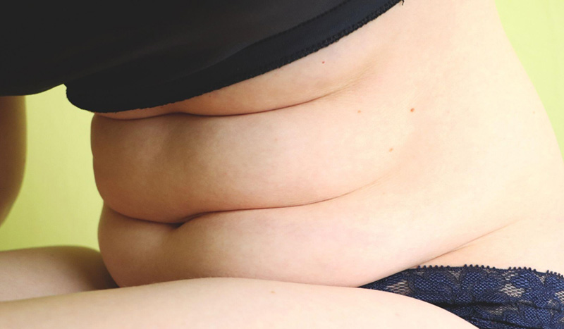 מה ההבדל בין שאיבת שומן למיחת בטן